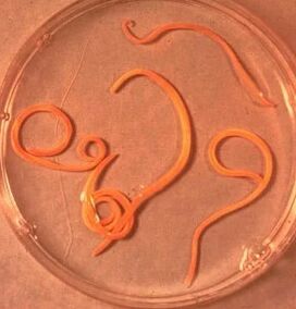 Parasiten des Ascarid -Mannes