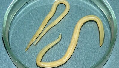 Wie man die Ascariasis -Tests richtig durchnimmt