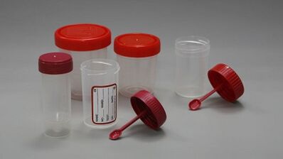 Wie man sich auf den Test von Parasiten vorbereitet