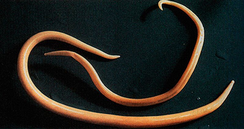 parasitärer Wurm aus dem menschlichen Körper